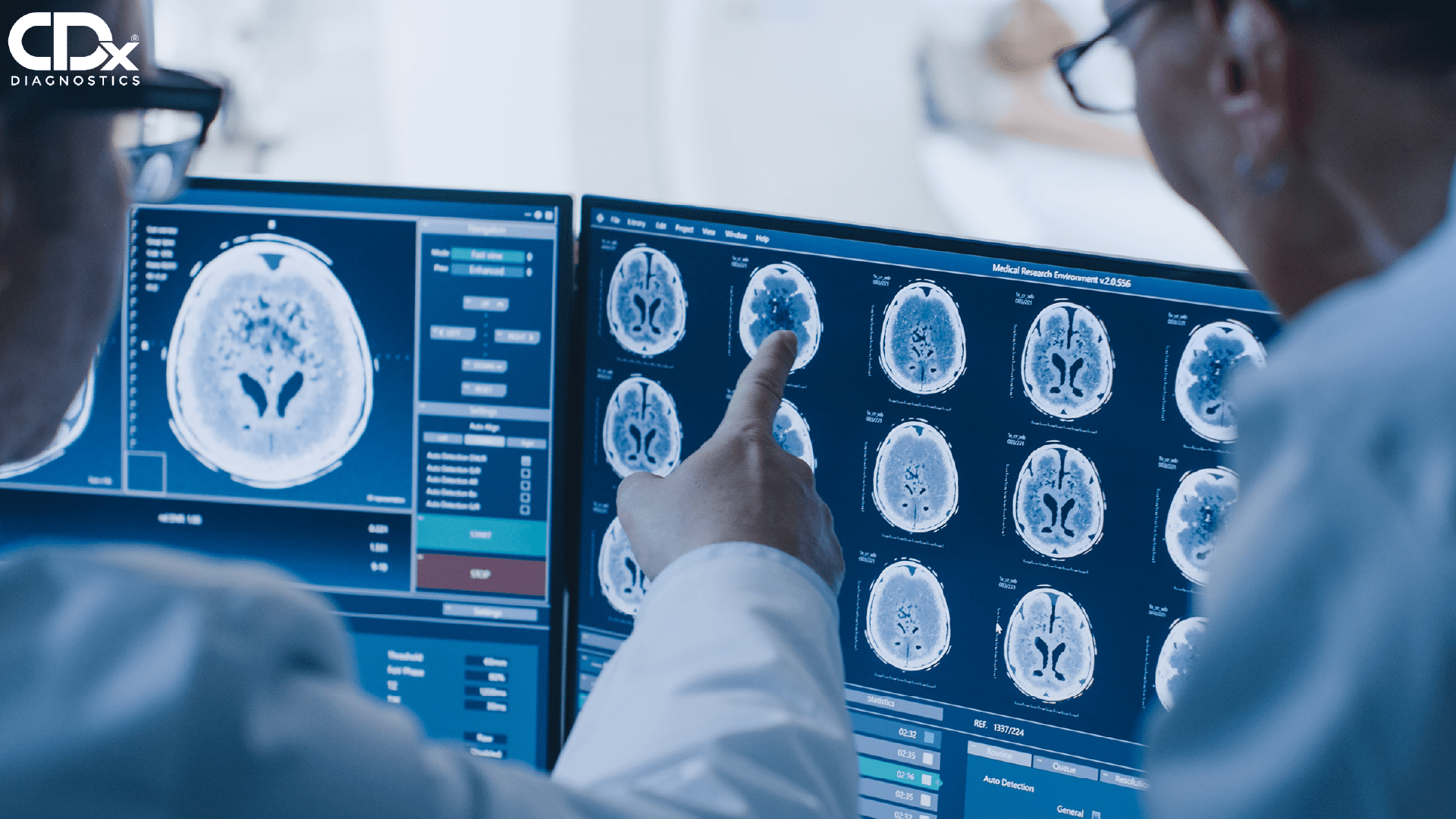 CDx Diagnostics introduces improved WATS3D sampling technique for enhanced esophageal cancer detection and earlier intervention.